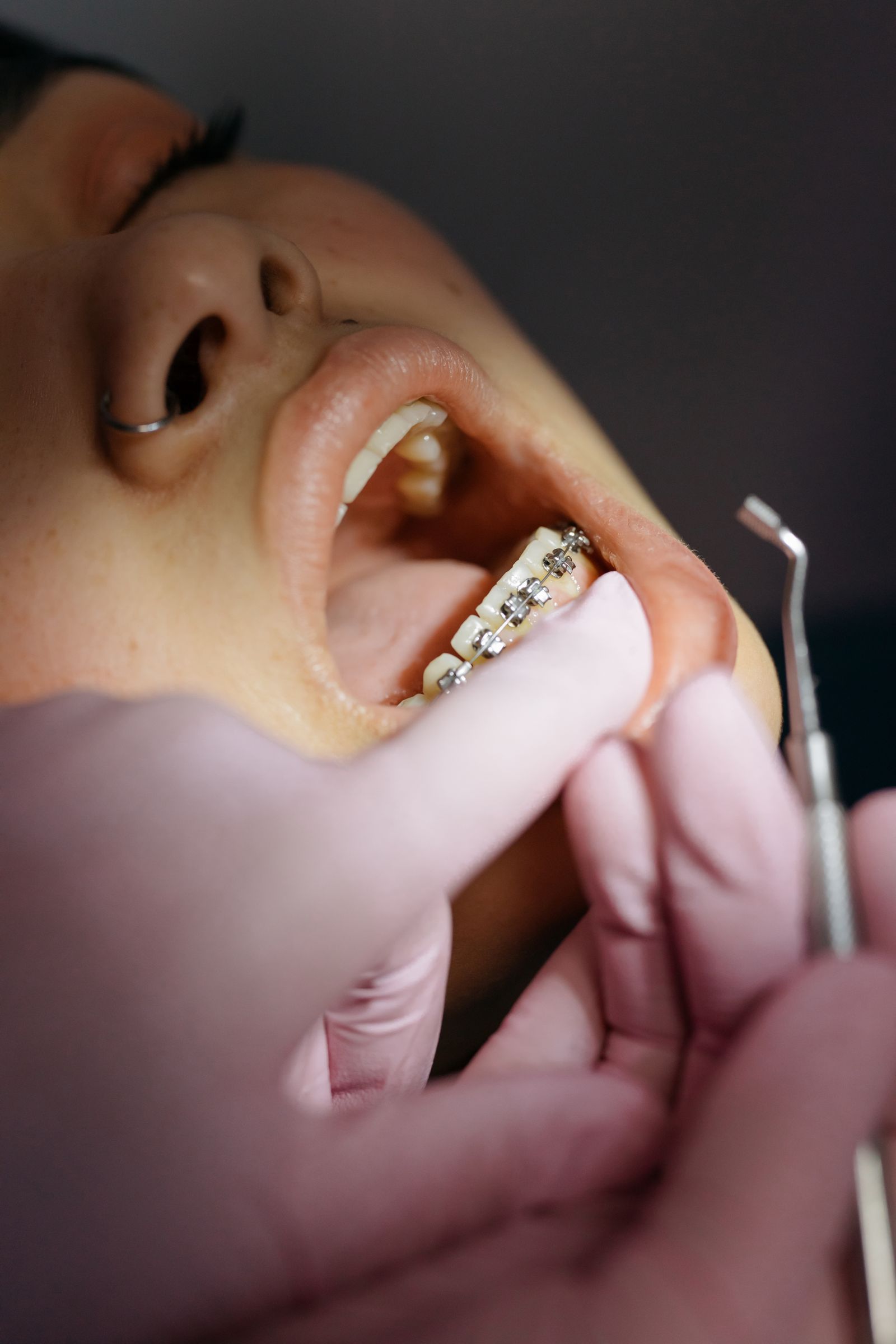 Dentist examining a patient's orthodontic braces during an appointment