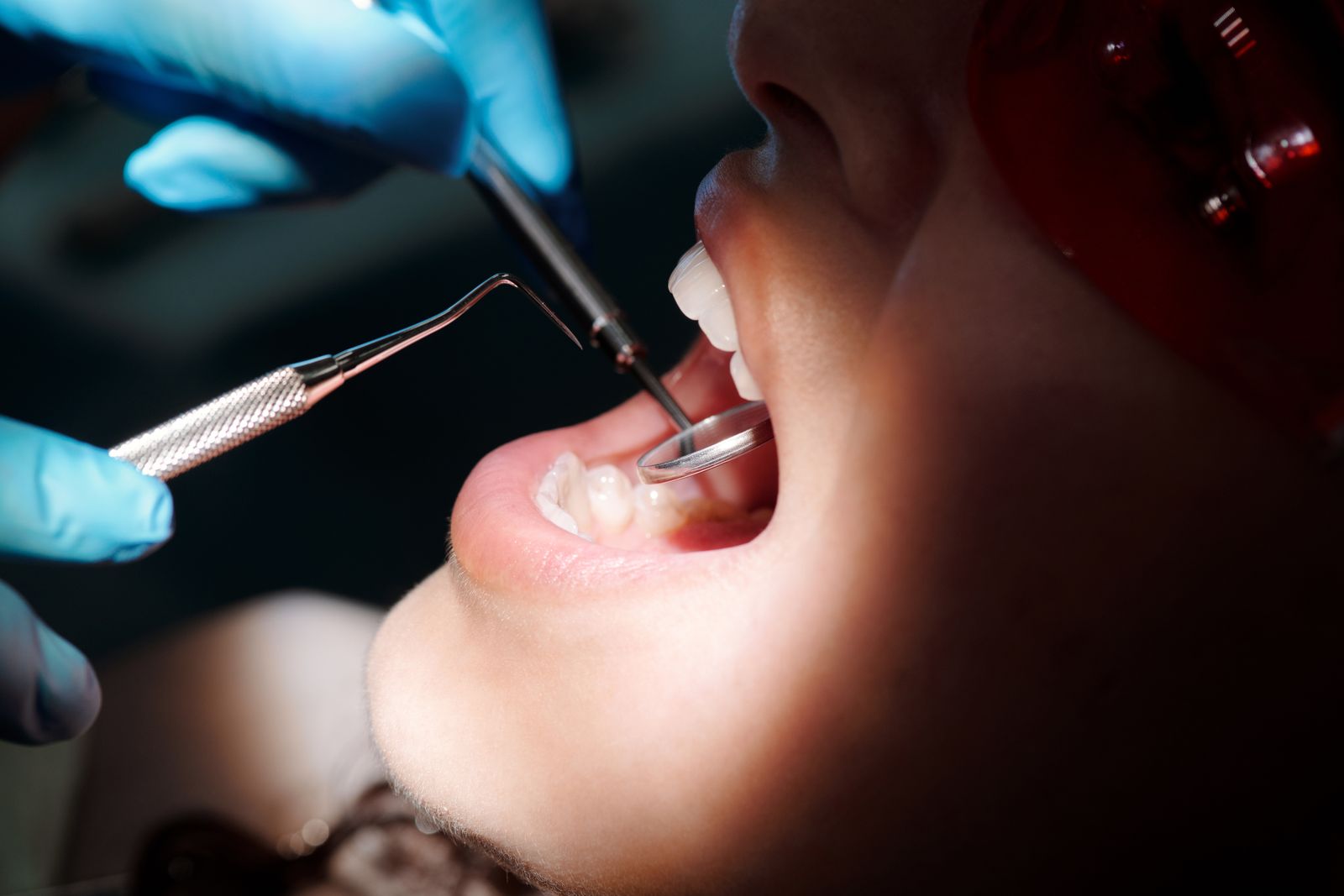 Close-up of a dental professional cleaning a patient's teeth with scaling instruments under bright light