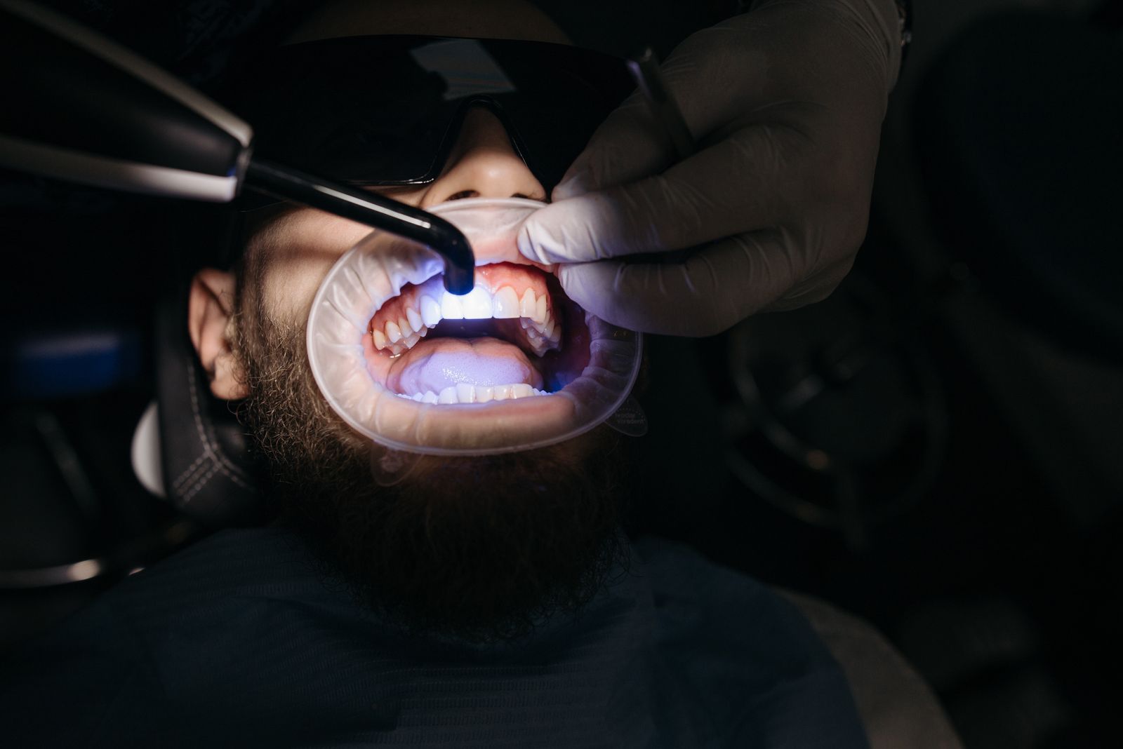 Dentist curing a tooth-colored filling with a dental light