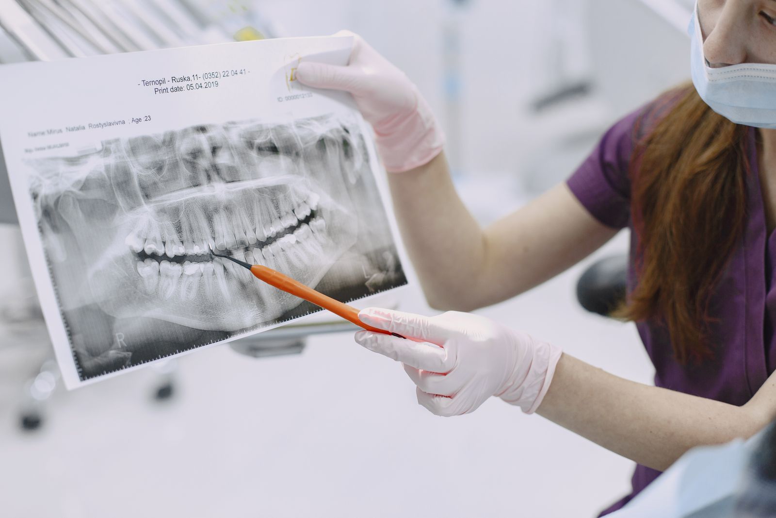 Dentist reviewing a panoramic jaw X-ray with a patient during a TMJ consultation